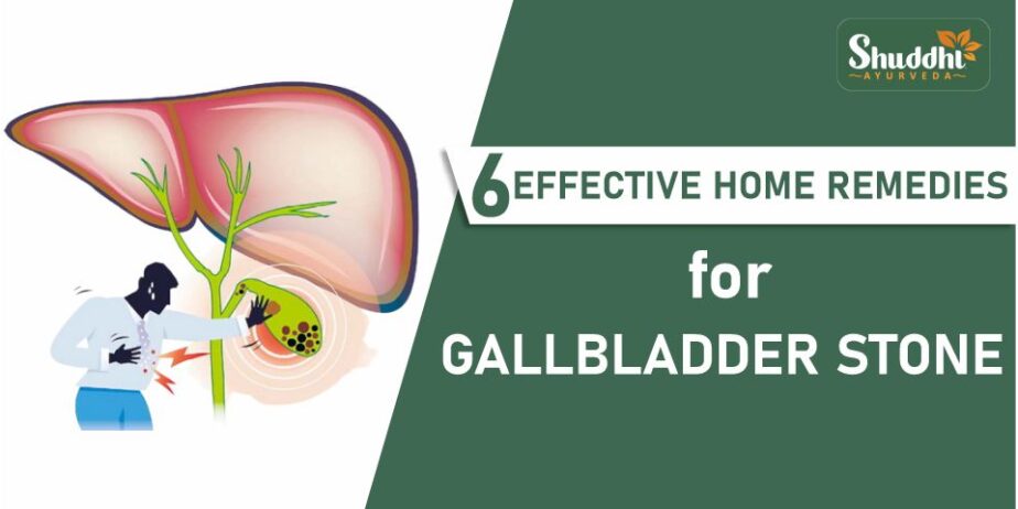 6 Effective Home Remedies For Gall Bladder Stone