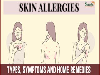 Skin-Allergies-Types-Symptoms-and-Home-Remedies