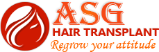 asg_hair_transplant